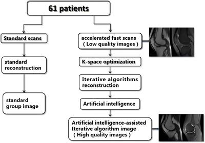 Feasibility of knee magnetic resonance imaging protocol using artificial intelligence-assisted iterative algorithm protocols: comparison with standard MRI protocols